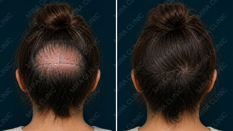 first phase of healing
